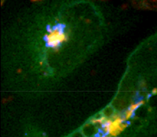 Two living  cells showing fluorescent sterol (green), a fluorescent lipid (blue) and an iron-carrying protein (transferrin, red)