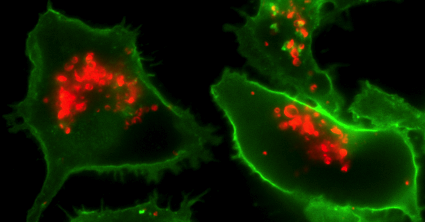 A microglial cell (green) has internalized Alzheimer’s amyloid protein (red)