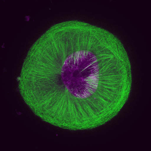 Gastric cancer cell treated with a tool compound showed a round and flat phenotype with strange MT bundles. MTs = green, purple = DAPI
