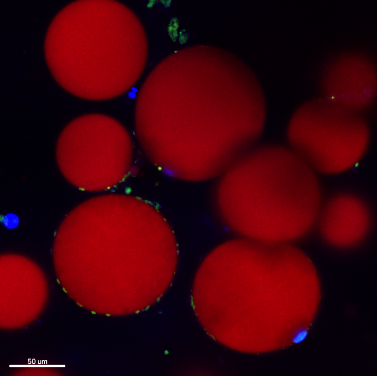 Primary human adipocytes isolated from breast tissue were stained with lipidTox (red)