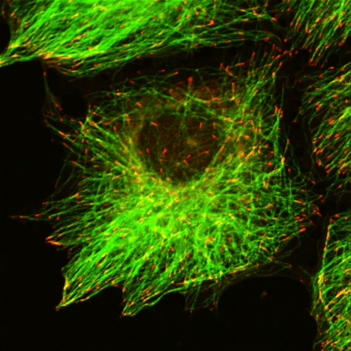 Gastric cancer cell stained with endogenous MT-end binding protein and MTs. MTs = green, red = end-binding protein